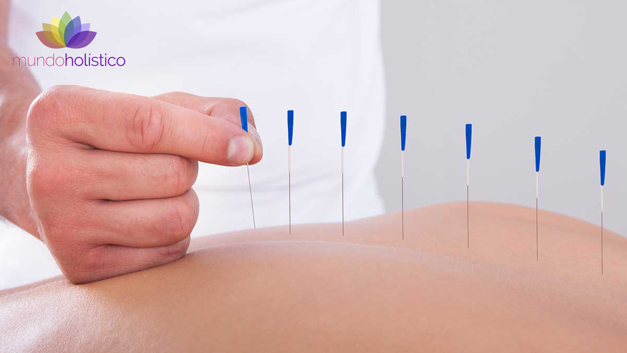 La acupuntura. Un componente de medicina china