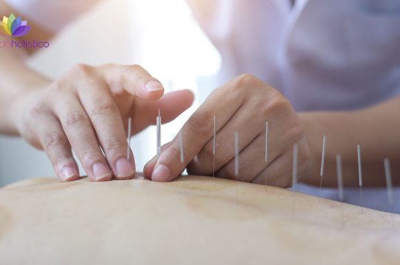 Beneficios de la acupuntura para personas mayores